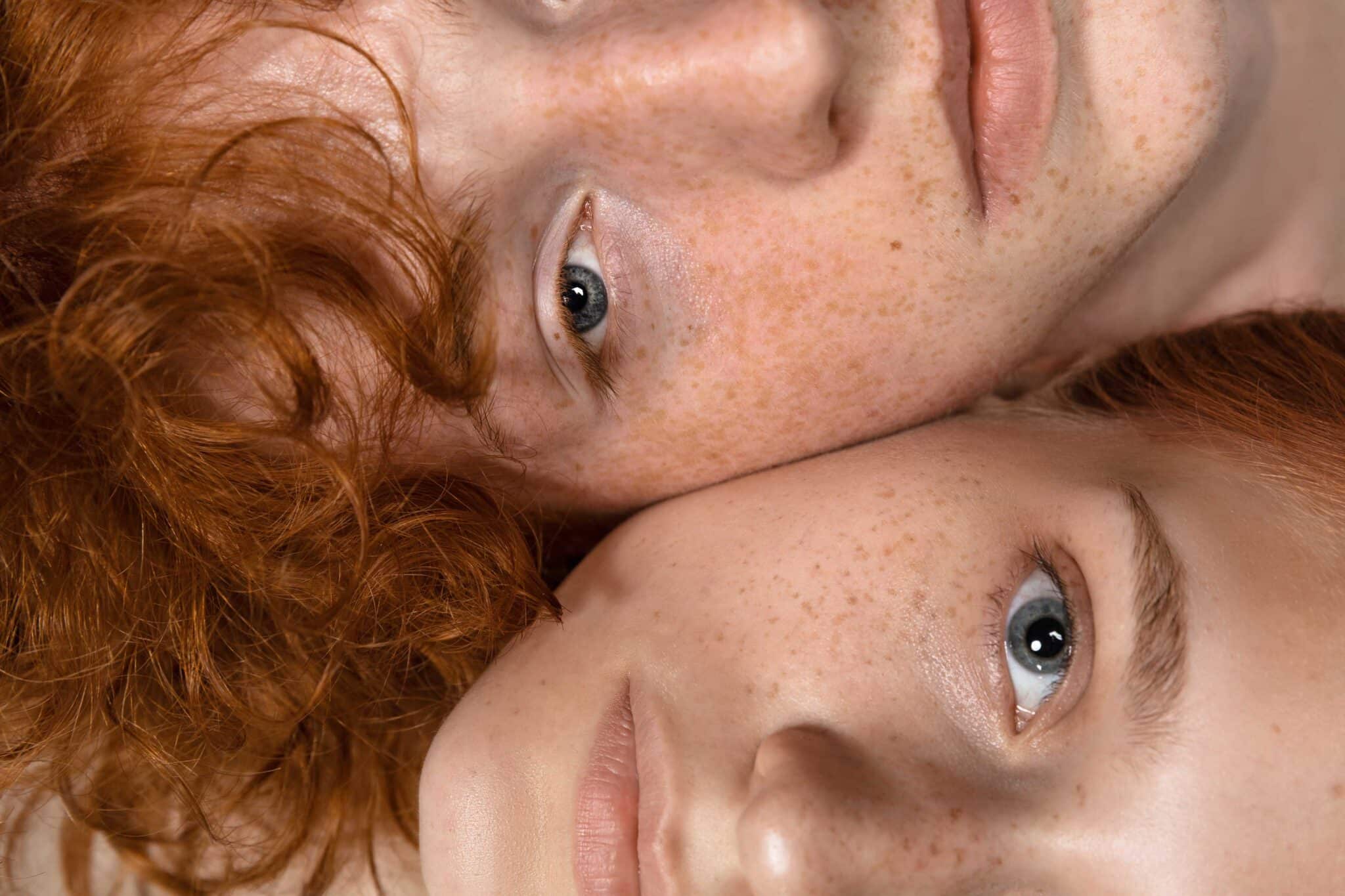 Fillers-behandling med hyaluronsyre for naturlig volum og ansiktskontur utført av erfaren estetisk lege i Oslo med trygge produkter som Restylane, Juvederm og Teosyal.